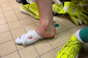 舍瓦利耶谈被踢伤：有时候有些动作必须避免，今天我算是非常幸运